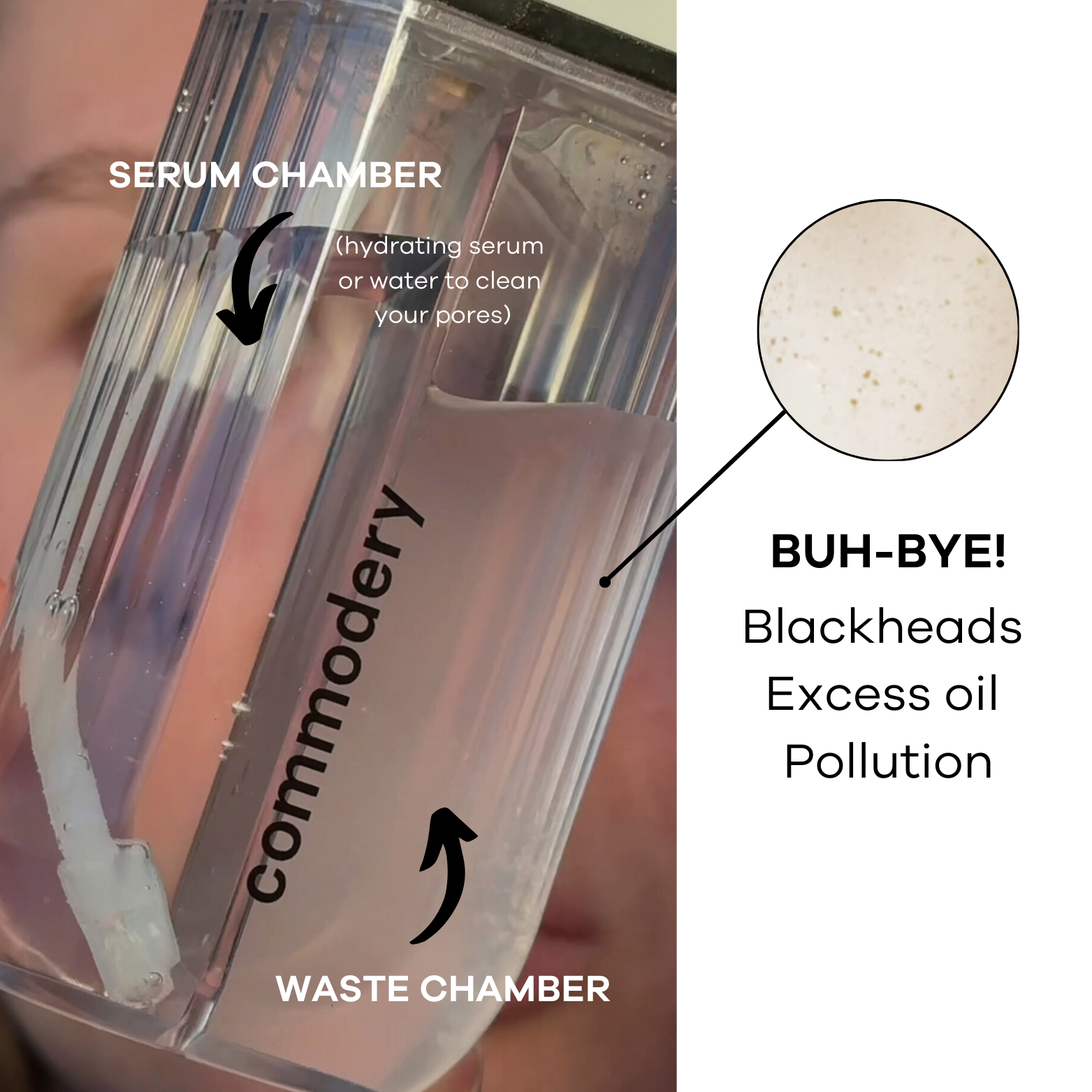 Suction + Skincare Distribution (3).png