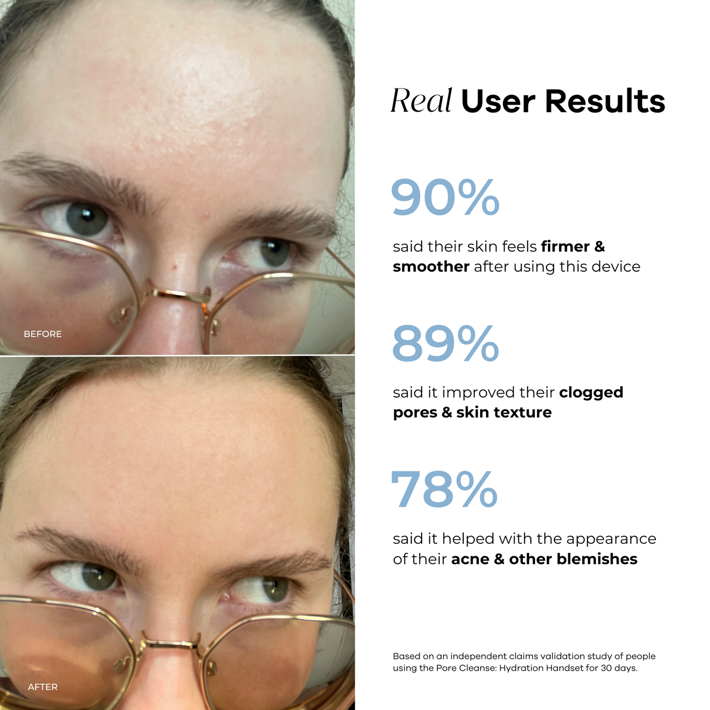 Hydration Handset & Hydra Soothe Serum Kit