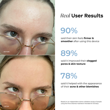 Hydration Handset & Hydra Soothe Serum Kit