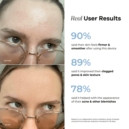 Hydration Handset & Serum Bundle